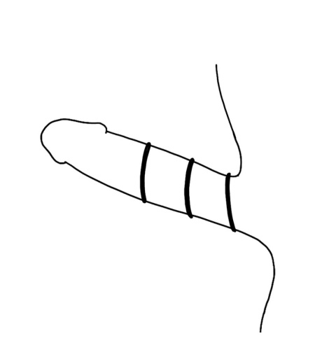 img 112742 9bf330ab062145de0da5ccb2e4bbf02e 1
